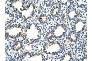 RAD23A antibody was used for immunohistochemistry at a concentration of 4-8 ug/ml to stain Alveolar cells (arrows) in Human Lung. (RAD23A antibody)