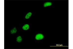 Immunofluorescence of purified MaxPab antibody to SLC4A1AP on HeLa cell. (NADAP antibody  (AA 1-796))