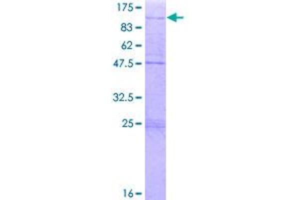 ZNF16 Protein (AA 1-682) (GST tag)