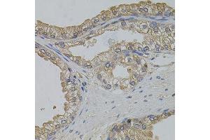Immunohistochemistry of paraffin-embedded human prostate using ARF1 antibody. (ARF1 antibody)