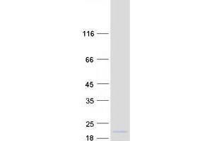 Western Blotting (WB) image for HOP Homeobox (HOPX) (Transcript Variant 1) protein (Myc-DYKDDDDK Tag) (ABIN2722944)