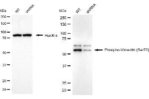 Western blotting analysis using phospho-vimentin (Ser72) antibody (ABIN7800835).