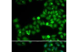 Immunofluorescence analysis of U2OS cells using POLK Polyclonal Antibody