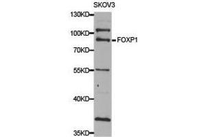 Western Blotting (WB) image for anti-Forkhead Box P1 (FOXP1) antibody (ABIN1876460) (FOXP1 antibody)
