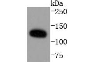 HeLa cell lysates probed with ERK5 (8D8) Monoclonal Antibody  at 1:1000 overnight at 4˚C. (MAPK7 antibody)