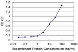 Detection limit for recombinant GST tagged IRAK4 is approximately 0. (IRAK4 antibody  (AA 255-351))
