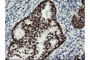 Image no. 9 for anti-Myeloid Leukemia Factor 1 (MLF1) antibody (ABIN1499493)