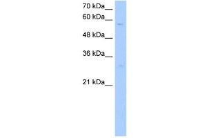 STEAP4 antibody used at 1 ug/ml to detect target protein. (STEAP4 antibody  (C-Term))