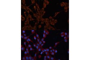Immunofluorescence (IF) image for anti-Insulin-Like Growth Factor 2 Receptor (IGF2R) (AA 2327-2491) antibody (ABIN6142247)