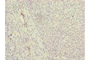 Immunohistochemistry of paraffin-embedded human tonsil tissue using ABIN7142250 at dilution of 1:100 (MRPS16 antibody  (AA 1-137))