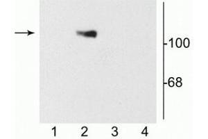 Western blot of 10 µg of HEK 293 cells showing specific immunolabeling of the ~120 kDa NR1 subunit of the NMDA receptor containing the C2 splice variant insert (lane 2). (GRIN1/NMDAR1 antibody)
