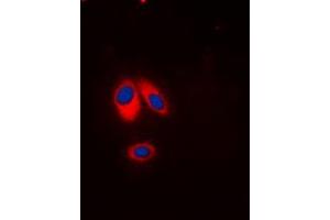 Immunofluorescent analysis of p47 phox (pS359) staining in HeLa cells. (NCF1 antibody  (C-Term, pSer359))