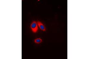 Immunofluorescent analysis of p47 phox (pS359) staining in HeLa cells.