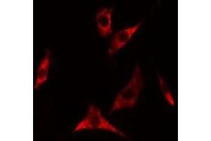 ABIN6275318 staining A549 cells by IF/ICC.