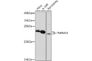Western blot analysis of extracts of various cell lines, using TMEM18 pAb (ABIN7270961) at 1:1000 dilution.