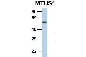 Host:  Rabbit  Target Name:  NSUN6  Sample Type:  Human Fetal Lung  Antibody Dilution:  1. (MTUS1 antibody  (Middle Region))