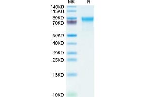 Mouse CADM1/IGSF4A on Tris-Bis PAGE under reduced condition. (CADM1 Protein (AA 48-388) (His tag))