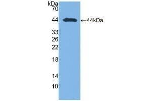 Detection of Recombinant AST, Human using Polyclonal Antibody to Aspartate Aminotransferase (AST) (GOT1 antibody  (AA 1-413))