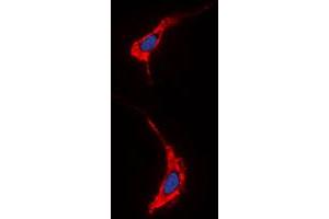 Immunofluorescent analysis of Neuregulin SMDF staining in A431 cells. (Neuregulin SMDF (N-Term) antibody)