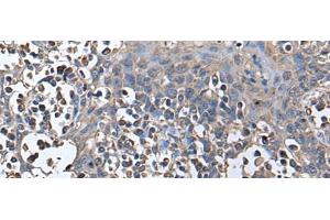 Immunohistochemistry of paraffin-embedded Human tonsil tissue using ZNHIT1 Polyclonal Antibody at dilution of 1:40(x200) (ZNHIT1 antibody)