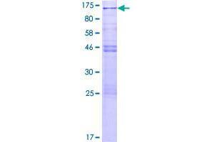 CSRP2BP Protein (AA 1-782) (GST tag)