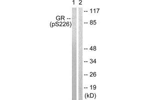 Western Blotting (WB) image for anti-GR (Internal Region), (pSer226), (pSer234), (pSer246) antibody (ABIN1847260) (GR (Internal Region), (pSer226), (pSer234), (pSer246) antibody)