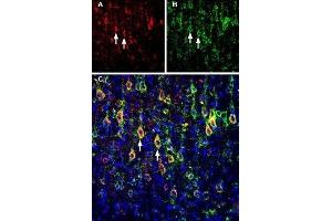 Immunohistochemistry (IHC) image for anti-SLIT and NTRK-Like Family, Member 1 (SLITRK1) (AA 383-397), (Extracellular) antibody (ABIN7043629)