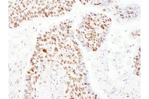 Immunohistochemistry (IHC) image for anti-PSME3 (PSME3) (AA 204-254) antibody (ABIN7454979) (PSME3 antibody  (AA 204-254))