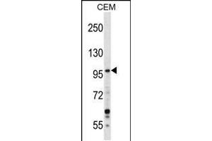 Western blot analysis in CEM cell line lysates (35ug/lane). (GREB1 antibody  (AA 1417-1446))