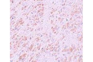 Immunohistochemistry of rat brain tissue with VENTX polyclonal antibody  at 5 ug/mL. (VENTX antibody  (Internal Region))