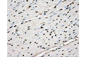 Immunohistochemical staining of paraffin-embedded liver tissue using anti-BSG mouse monoclonal antibody. (CD147 antibody)