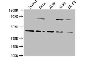 Western Blot Positive WB detected in: Jurkat whole cell lysate, Hela whole cell lysate, A549 whole cell lysate, K562 whole cell lysate, HL60 whole cell lysate All lanes: LMX1A antibody at 1:2000 Secondary Goat polyclonal to rabbit IgG at 1/50000 dilution Predicted band size: 43, 15 kDa Observed band size: 43 kDa