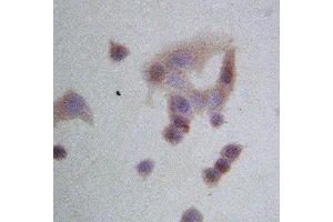 Immunohistochemistry (IHC) image for anti-Heat Shock Protein 90kDa beta (Grp94), Member 1 (HSP90B1) (AA 687-700), (Middle Region) antibody (ABIN3044299)