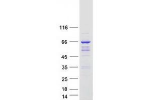 Validation with Western Blot (ARHGAP9 Protein (Transcript Variant 3) (Myc-DYKDDDDK Tag))