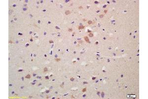 Formalin-fixed and paraffin embedded rat brain labeled with Anti-GRK1 Polyclonal Antibody, Unconjugated (ABIN737391) at 1:200 followed by conjugation to the secondary antibody and DAB staining. (GRK1 antibody)