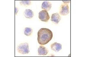 Immunocytochemistry of PERP in A431 cells with this product at 10 μg/ml. (PERP antibody  (C-Term))