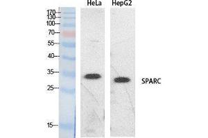 Western Blotting (WB) image for anti-Secreted Protein, Acidic, Cysteine-Rich (Osteonectin) (SPARC) (Internal Region) antibody (ABIN3187993) (SPARC antibody  (Internal Region))