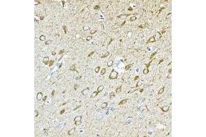 Immunohistochemistry of paraffin-embedded rat brain using GPLD1 Rabbit pAb (ABIN6131716, ABIN6141335, ABIN6141336 and ABIN6222300) at dilution of 1:100 (40x lens).