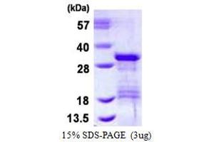 Vesicle Transport through Interaction with T-SNAREs Homolog 1B (VTI1B) (AA 1-208) protein (His tag)