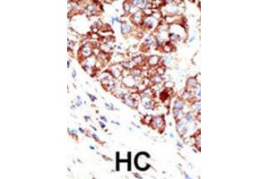 Immunohistochemistry (IHC) image for anti-Protein Inhibitor of Activated STAT, 1 (PIAS1) antibody (ABIN2996746)