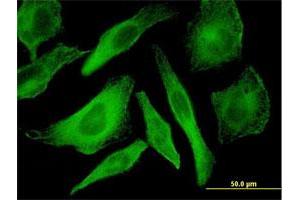 Immunofluorescence (IF) image for anti-Mitogen-Activated Protein Kinase 12 (MAPK12) (AA 1-367) antibody (ABIN562793)
