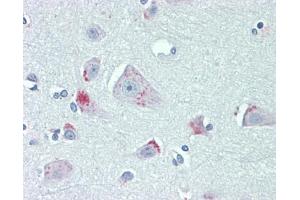 Human Brain, Cortex: Formalin-Fixed, Paraffin-Embedded (FFPE), at a dilution of 1:100. (G2E3 antibody  (AA 226-252))