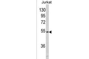 Western blot analysis of MF 928b in Jurkat cell line lysates (35 μg/lane). (MFAP1 antibody  (N-Term))