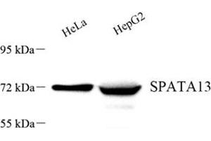 Western blot analysis of SPATA13 (ABIN7075700) at dilution of 1: 500 (SPATA13 antibody)