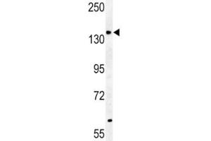 Western Blotting (WB) image for anti-ATP-Binding Cassette, Sub-Family B (MDR/TAP), Member 4 (ABCB4) (AA 624-654) antibody (ABIN3030051)