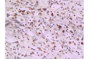 Formalin-fixed and paraffin embedded rat colon tissue labeled with Anti-PAF Polyclonal Antibody, Unconjugated (ABIN737931) at 1:200 followed by conjugation to the secondary antibody and DAB staining (KIAA0101 antibody)
