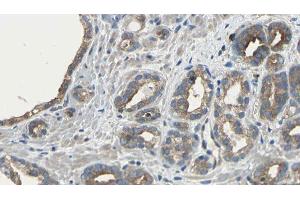 ABIN6275481 at 1/100 staining Human prostate tissue by IHC-P. (RGS5 antibody  (Internal Region))