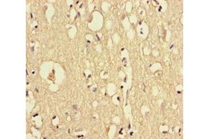 Immunohistochemistry of paraffin-embedded human brain tissue using ABIN7149595 at dilution of 1:100 (DOCK6 antibody  (AA 499-616))
