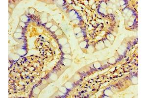 Immunohistochemistry of paraffin-embedded human small intestine tissue using ABIN7173221 at dilution of 1:100 (TMEM44 antibody  (AA 269-439))