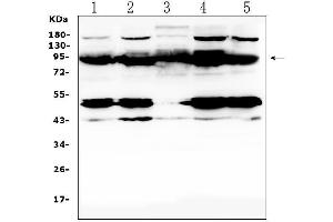 anti-Tyrosine-Protein Phosphatase Non-Receptor Type 22 (PTPN22) (AA 1-309) antibody